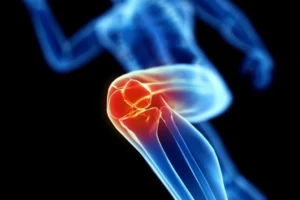 Hexarelin CJC 1295 Stack for Boosting Joint and Tendon Healing