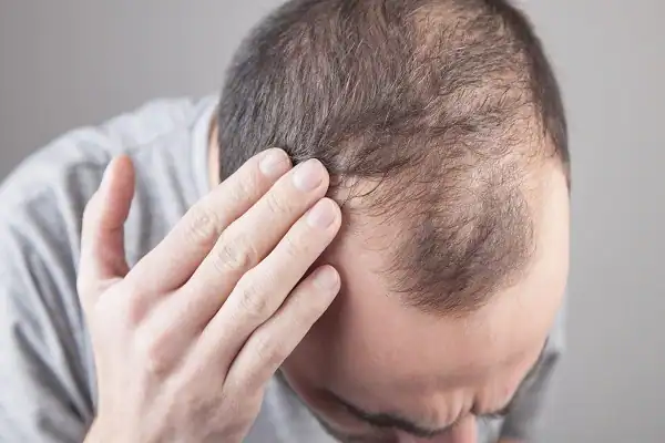 Best Peptides for Hair Growth